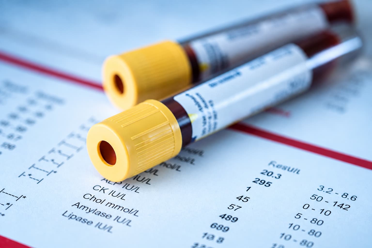 Blood sample tubes resting on a lab results sheet